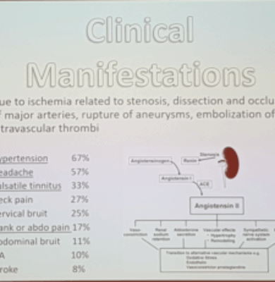 clinical manifestations