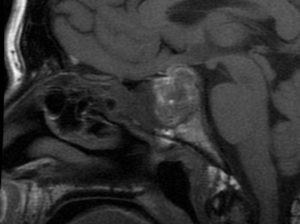 Endocrinology