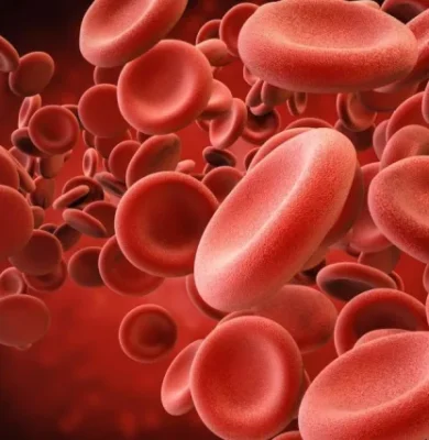 Large Vessel Vascilitis