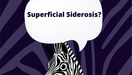 superficial siderosis superficial siderosis