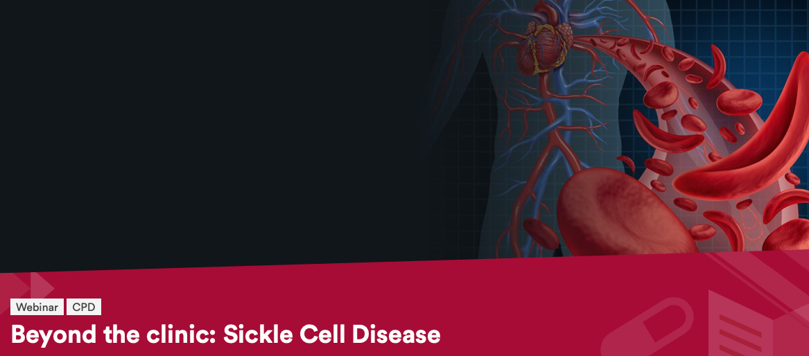 beyond the clinic sickle cell