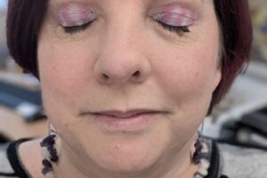 rare disease day 2025